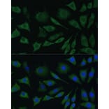 Immunofluorescence - Anti-BMPR1B Antibody (A13804) - Antibodies.com