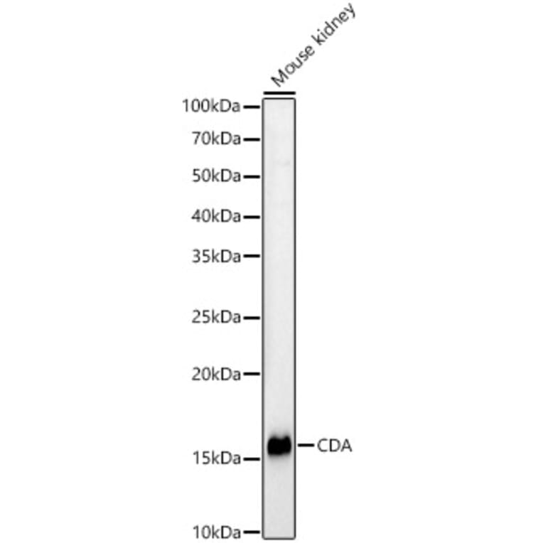 Western Blot - Anti-CDA Antibody (A13805) - Antibodies.com