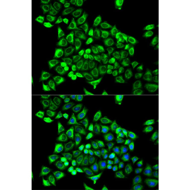 Immunofluorescence - Anti-CDA Antibody (A13805) - Antibodies.com