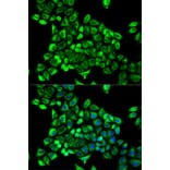 Immunofluorescence - Anti-CDA Antibody (A13805) - Antibodies.com