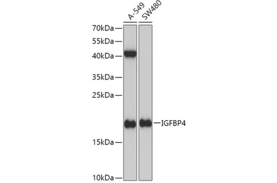 Western Blot - Anti-IGFBP4 Antibody (A13806) - Antibodies.com
