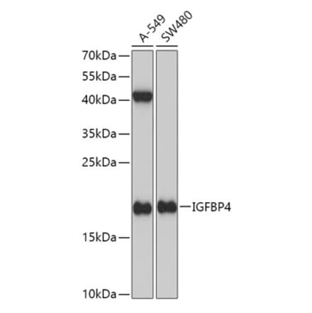 Western Blot - Anti-IGFBP4 Antibody (A13806) - Antibodies.com