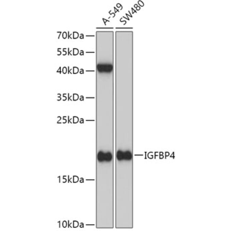 Western Blot - Anti-IGFBP4 Antibody (A13806) - Antibodies.com