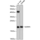 Western Blot - Anti-IGFBP4 Antibody (A13806) - Antibodies.com