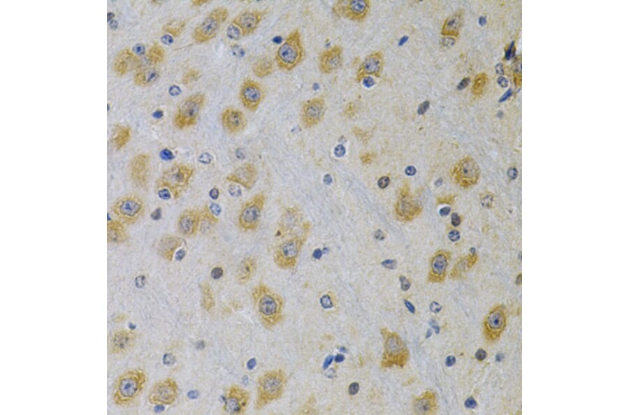 Immunohistochemistry - Anti-IGFBP4 Antibody (A13806) - Antibodies.com