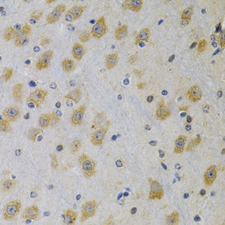 Immunohistochemistry - Anti-IGFBP4 Antibody (A13806) - Antibodies.com
