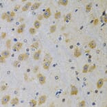 Immunohistochemistry - Anti-IGFBP4 Antibody (A13806) - Antibodies.com