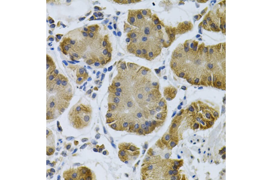Immunohistochemistry - Anti-IGFBP4 Antibody (A13806) - Antibodies.com