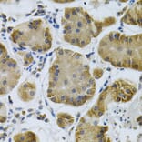 Immunohistochemistry - Anti-IGFBP4 Antibody (A13806) - Antibodies.com