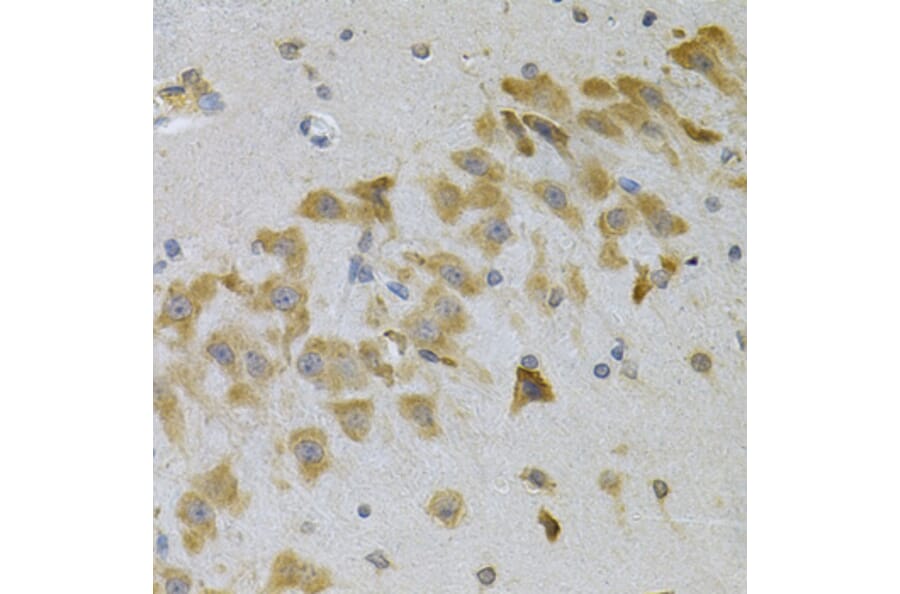 Immunohistochemistry - Anti-IGFBP4 Antibody (A13806) - Antibodies.com