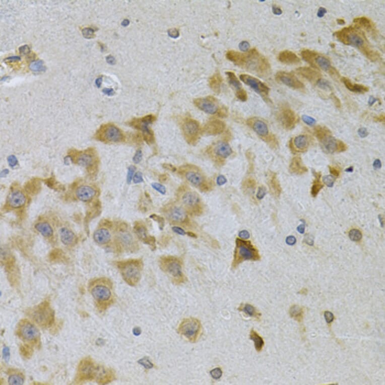 Immunohistochemistry - Anti-IGFBP4 Antibody (A13806) - Antibodies.com