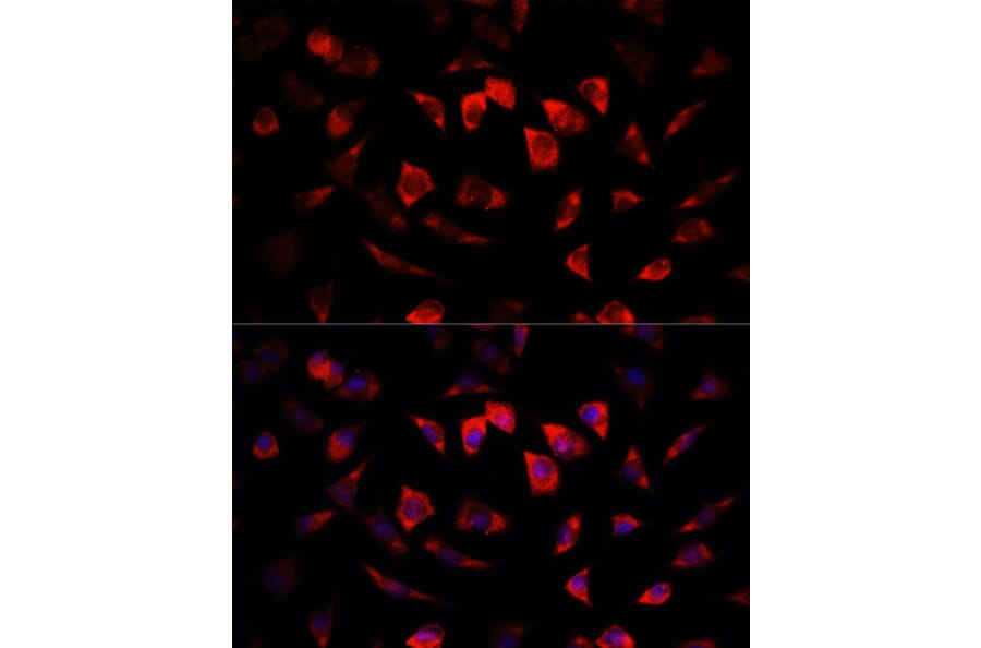 Immunofluorescence - Anti-IGFBP4 Antibody (A13806) - Antibodies.com