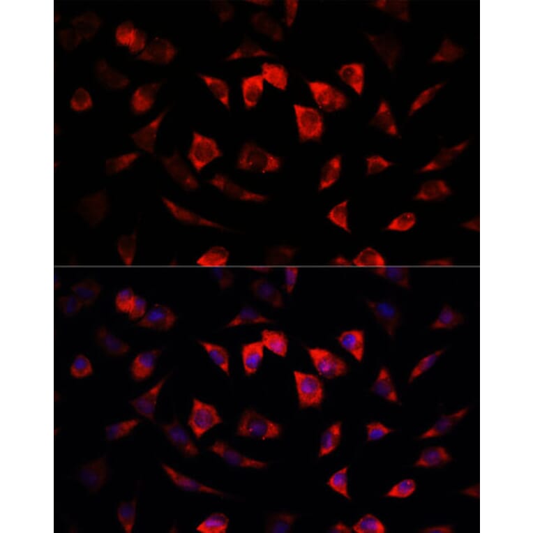 Immunofluorescence - Anti-IGFBP4 Antibody (A13806) - Antibodies.com