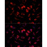 Immunofluorescence - Anti-IGFBP4 Antibody (A13806) - Antibodies.com