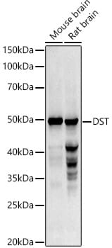 Western blot analysis of extracts of various cell lines, using Anti-DST Antibody (A2013).
Secondary antibody: Goat Anti-Rabbit IgG (H+L) (HRP) (AS014) at 1:10,000 dilution.
Lysates / proteins: 25µg per lane.
Blocking buffer: 3% non-fat dry milk in TBST.