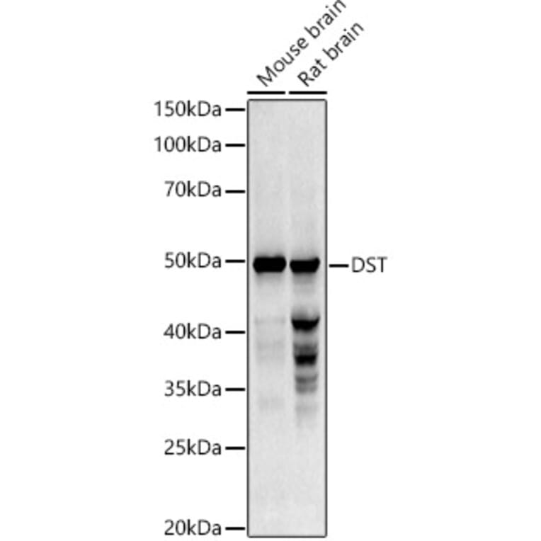 Western Blot - Anti-Dystonin/BPA Antibody (A13808) - Antibodies.com