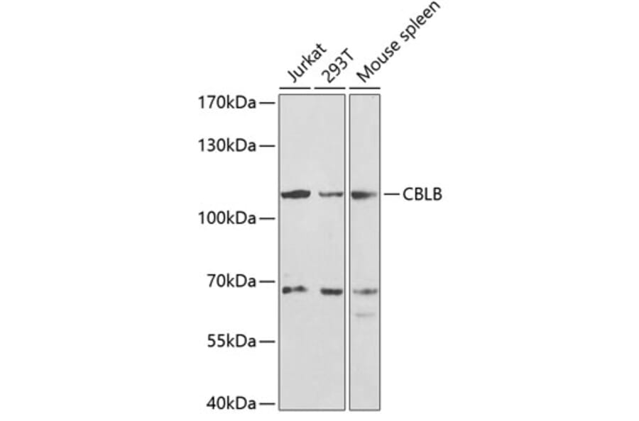 Western Blot - Anti-CBLB Antibody (A13809) - Antibodies.com