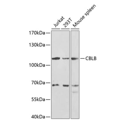 Western Blot - Anti-CBLB Antibody (A13809) - Antibodies.com