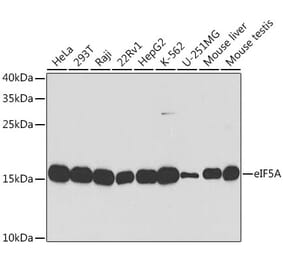 Western Blot - Anti-eIF5A Antibody (A13810) - Antibodies.com