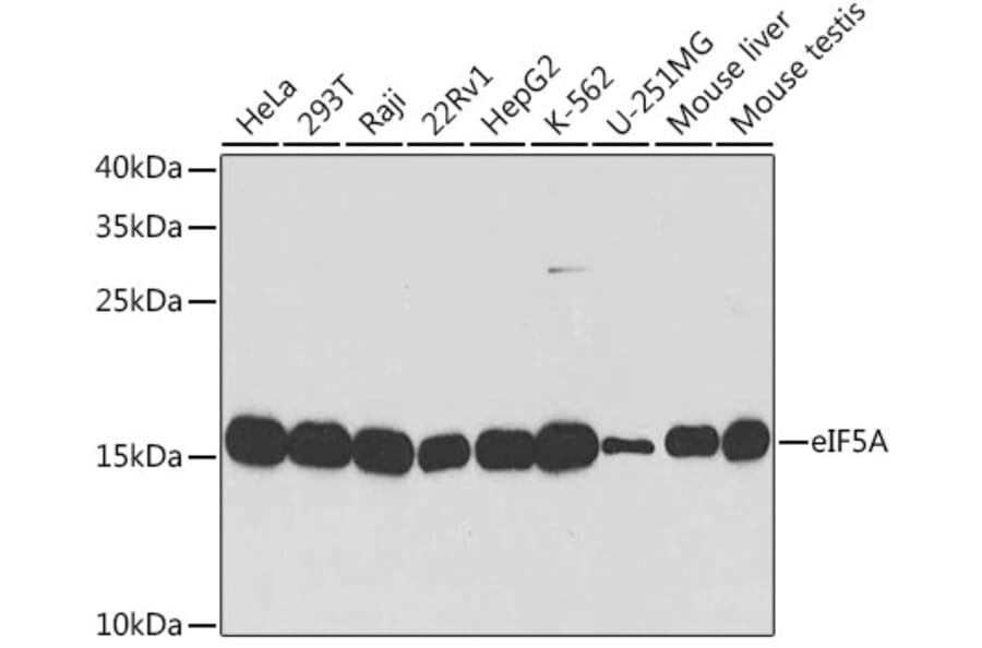 Western Blot - Anti-eIF5A Antibody (A13810) - Antibodies.com