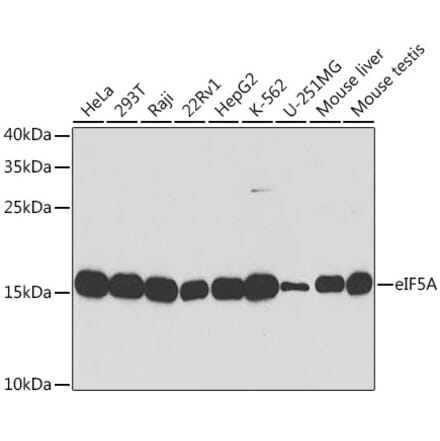 Western Blot - Anti-eIF5A Antibody (A13810) - Antibodies.com