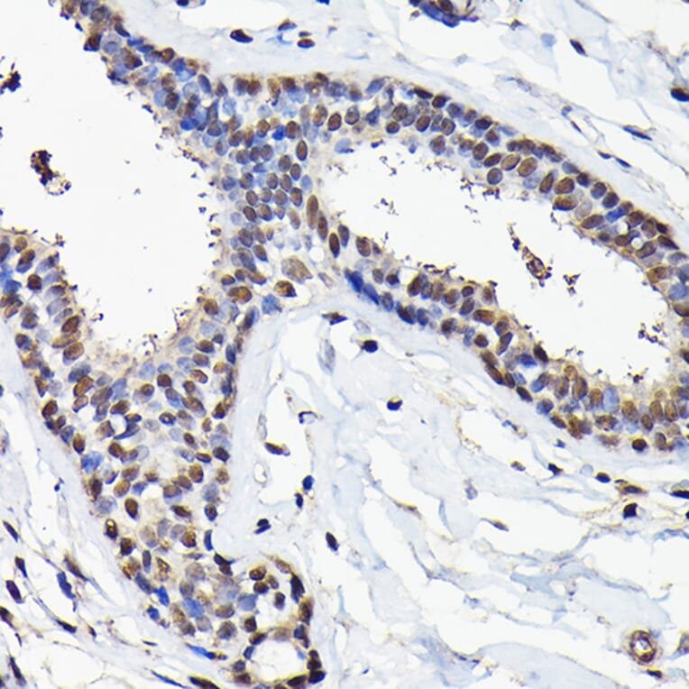 Immunohistochemistry - Anti-eIF5A Antibody (A13810) - Antibodies.com