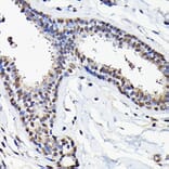 Immunohistochemistry - Anti-eIF5A Antibody (A13810) - Antibodies.com