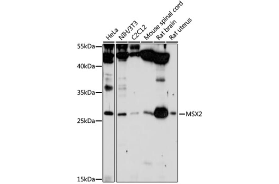 Western Blot - Anti-Msx2 / Hox8 Antibody (A13811) - Antibodies.com