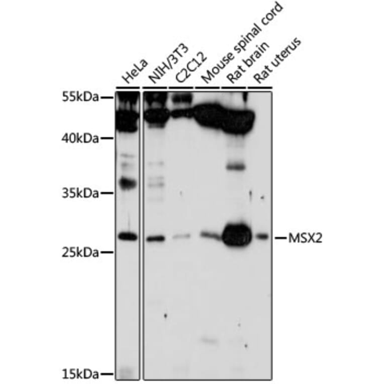 Western Blot - Anti-Msx2 / Hox8 Antibody (A13811) - Antibodies.com
