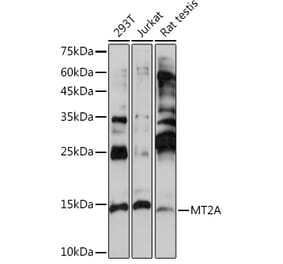 Western Blot - Anti-Metallothionein Antibody (A13812) - Antibodies.com