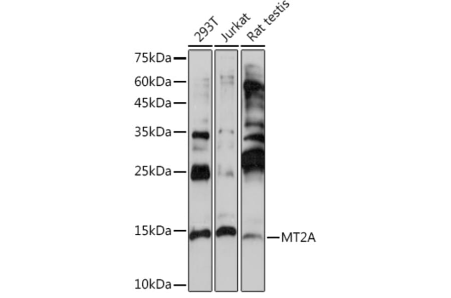 Western Blot - Anti-Metallothionein Antibody (A13812) - Antibodies.com