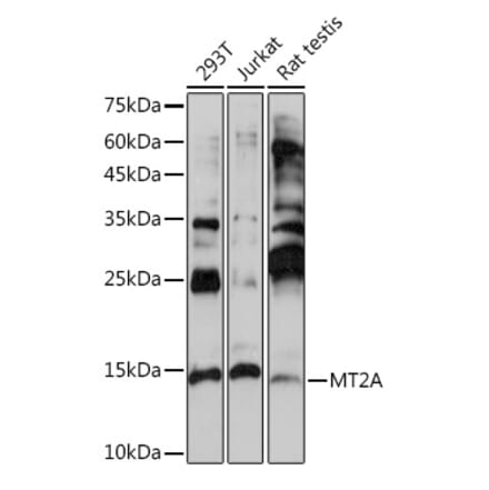 Western Blot - Anti-Metallothionein Antibody (A13812) - Antibodies.com