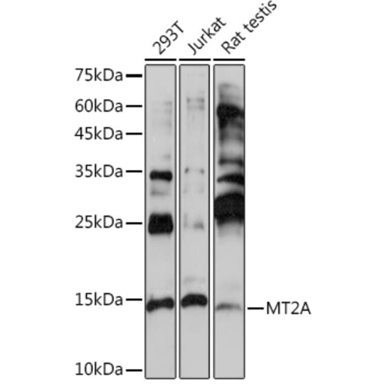 Western Blot - Anti-Metallothionein Antibody (A13812) - Antibodies.com