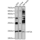 Western Blot - Anti-Metallothionein Antibody (A13812) - Antibodies.com