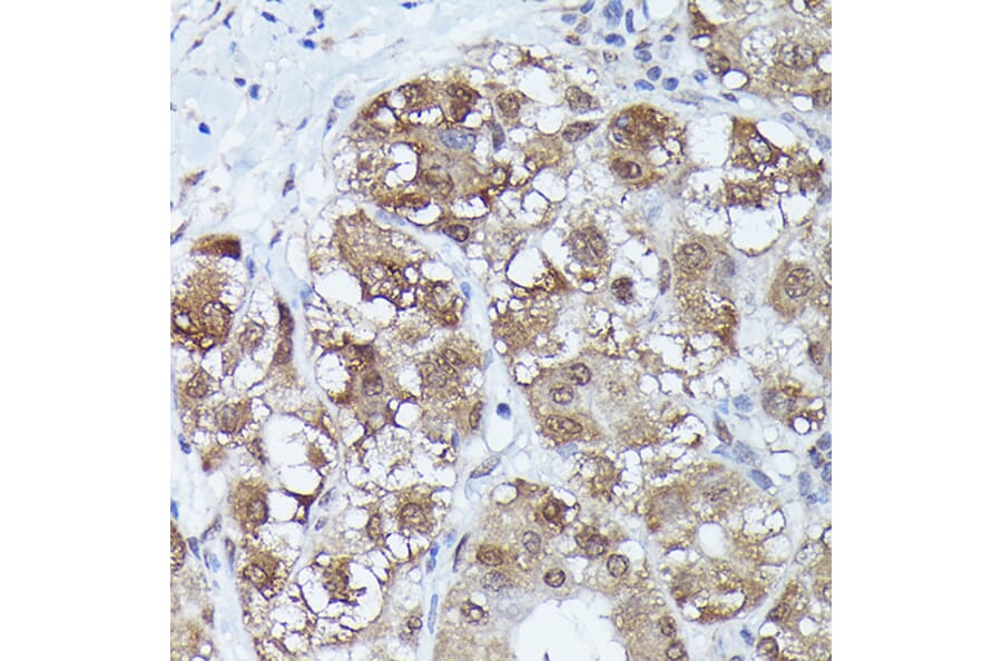 Immunohistochemistry - Anti-Metallothionein Antibody (A13812) - Antibodies.com