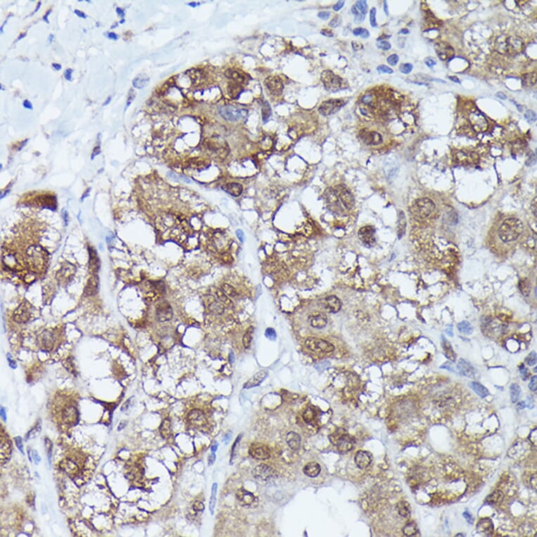 Immunohistochemistry - Anti-Metallothionein Antibody (A13812) - Antibodies.com