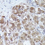 Immunohistochemistry - Anti-Metallothionein Antibody (A13812) - Antibodies.com