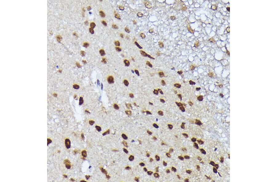 Immunohistochemistry - Anti-Metallothionein Antibody (A13812) - Antibodies.com