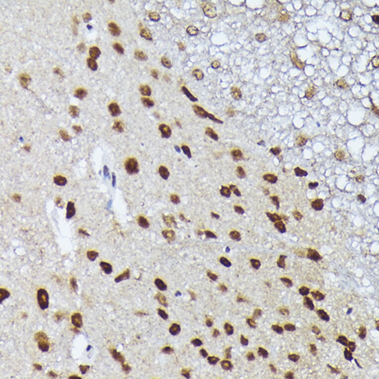 Immunohistochemistry - Anti-Metallothionein Antibody (A13812) - Antibodies.com