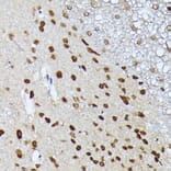Immunohistochemistry - Anti-Metallothionein Antibody (A13812) - Antibodies.com