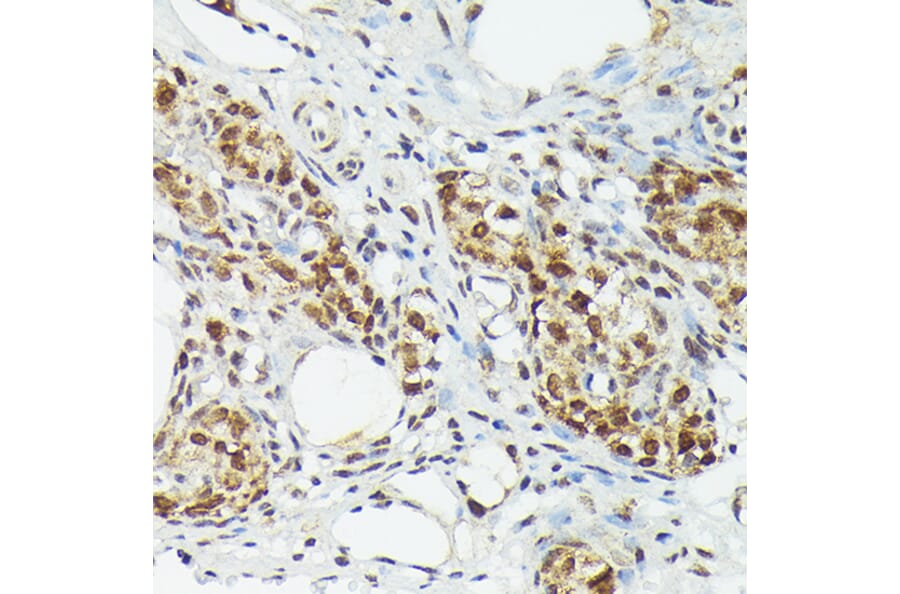 Immunohistochemistry - Anti-Metallothionein Antibody (A13812) - Antibodies.com