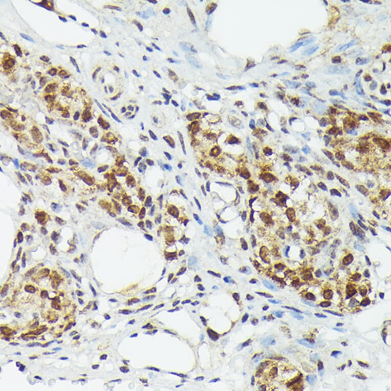 Immunohistochemistry - Anti-Metallothionein Antibody (A13812) - Antibodies.com