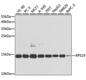 Western Blot - Anti-RPS19 Antibody (A13813) - Antibodies.com