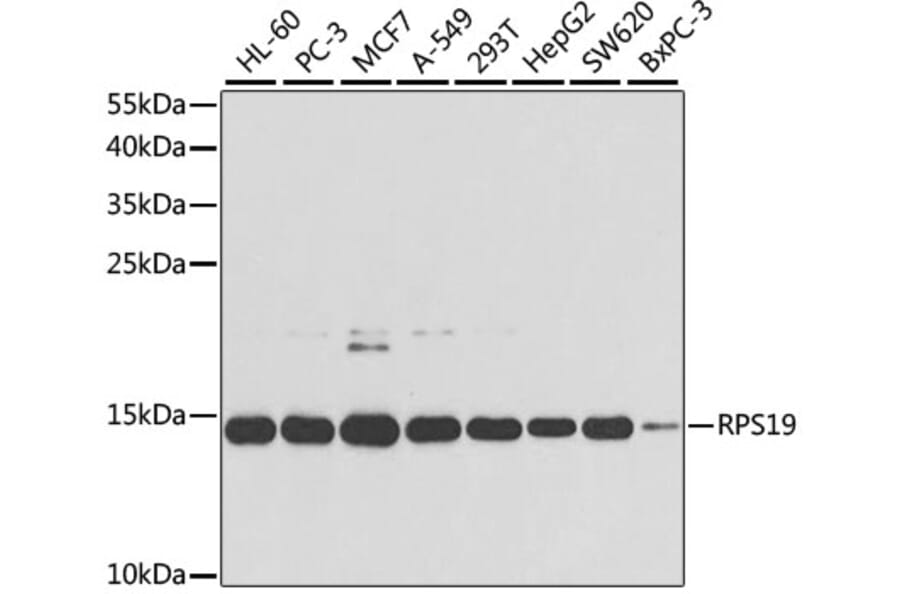 Western Blot - Anti-RPS19 Antibody (A13813) - Antibodies.com