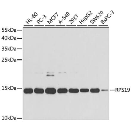 Western Blot - Anti-RPS19 Antibody (A13813) - Antibodies.com