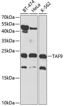 Western blot analysis of extracts of various cell lines, using Anti-TAF9 Antibody (A2021) at 1:1,000 dilution.
Secondary antibody: Goat Anti-Rabbit IgG (H+L) (HRP) (AS014) at 1:10,000 dilution.
Lysates / proteins: 25µg per lane.
Blocking buffer: 3% non-fat dry milk in TBST.