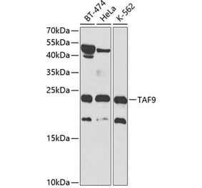 Western Blot - Anti-TAF9 Antibody (A13815) - Antibodies.com