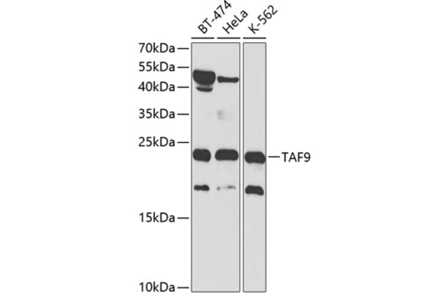 Western Blot - Anti-TAF9 Antibody (A13815) - Antibodies.com