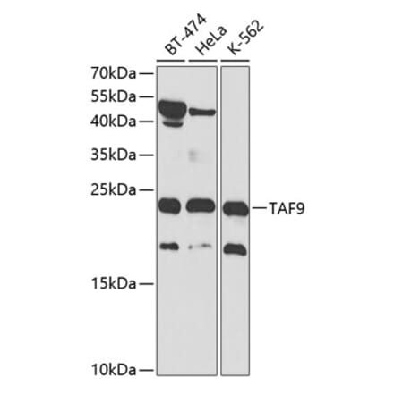 Western Blot - Anti-TAF9 Antibody (A13815) - Antibodies.com