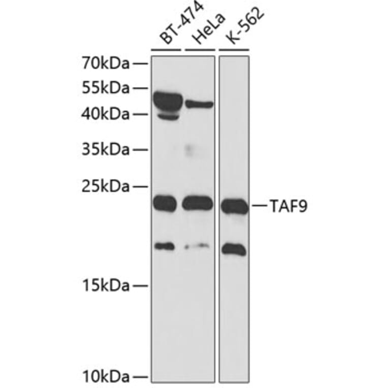 Western Blot - Anti-TAF9 Antibody (A13815) - Antibodies.com